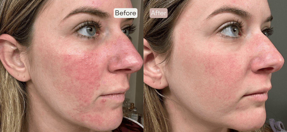 Radiant Duo Before & After