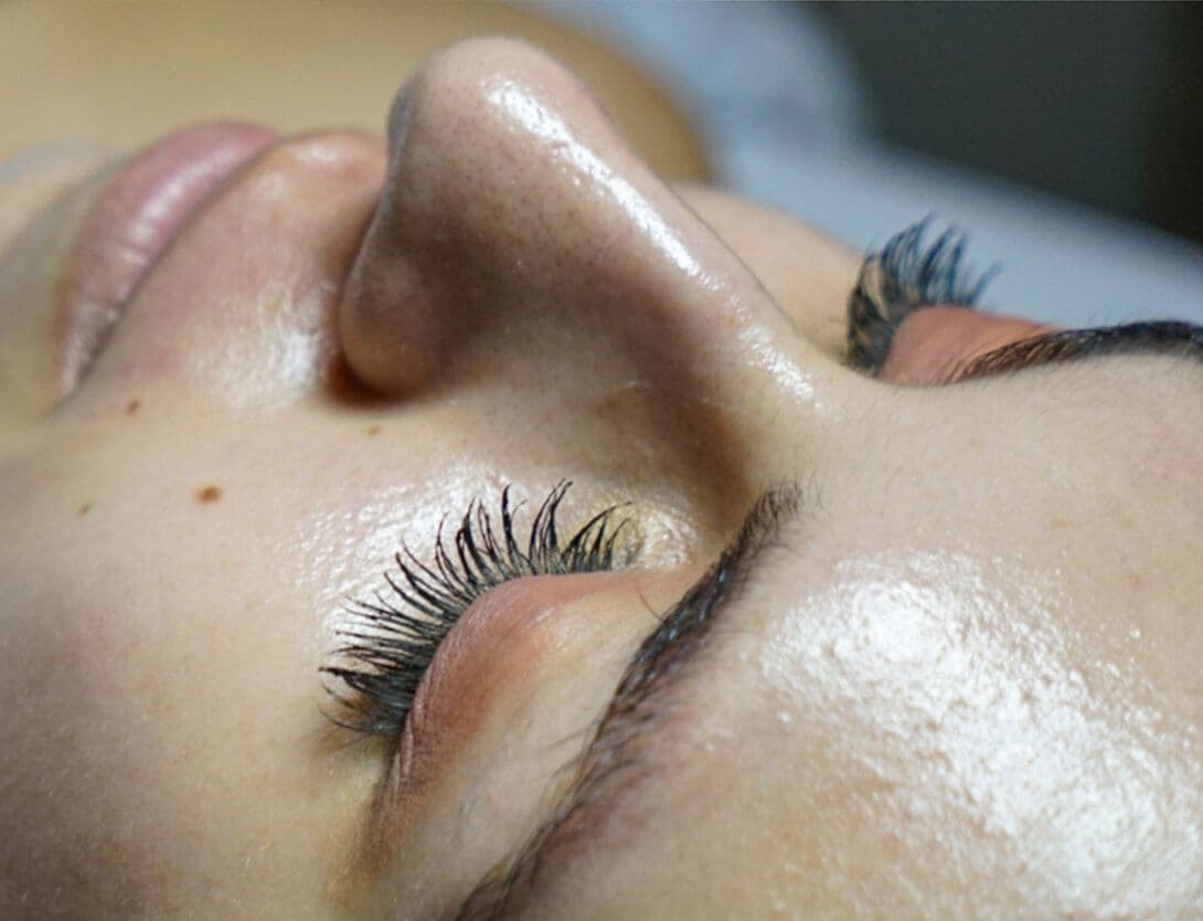 ErinFacial after