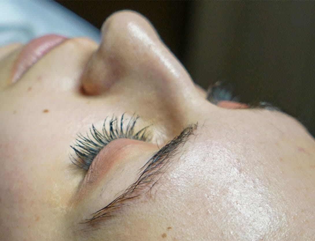 ErinFacial