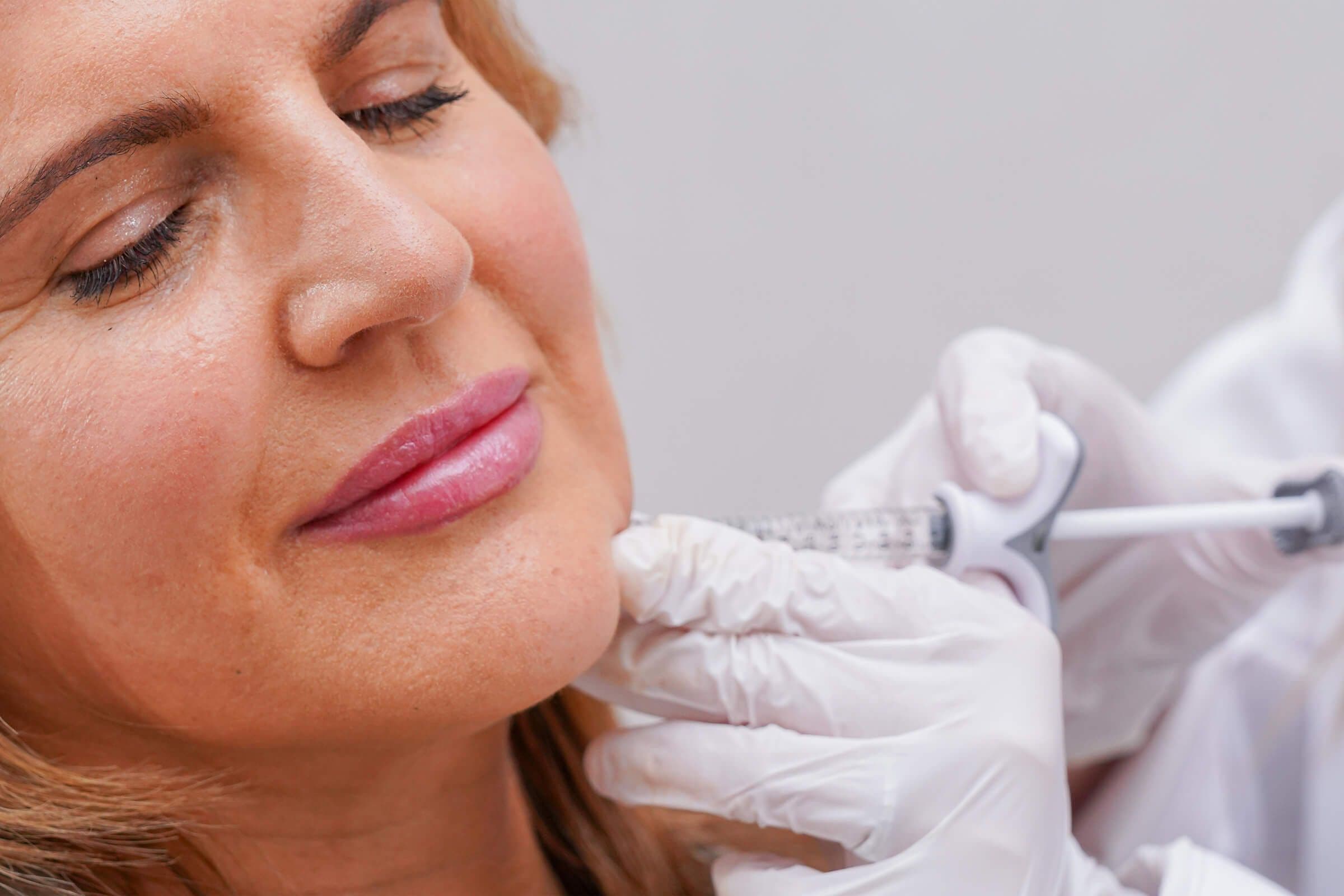 Juvederm