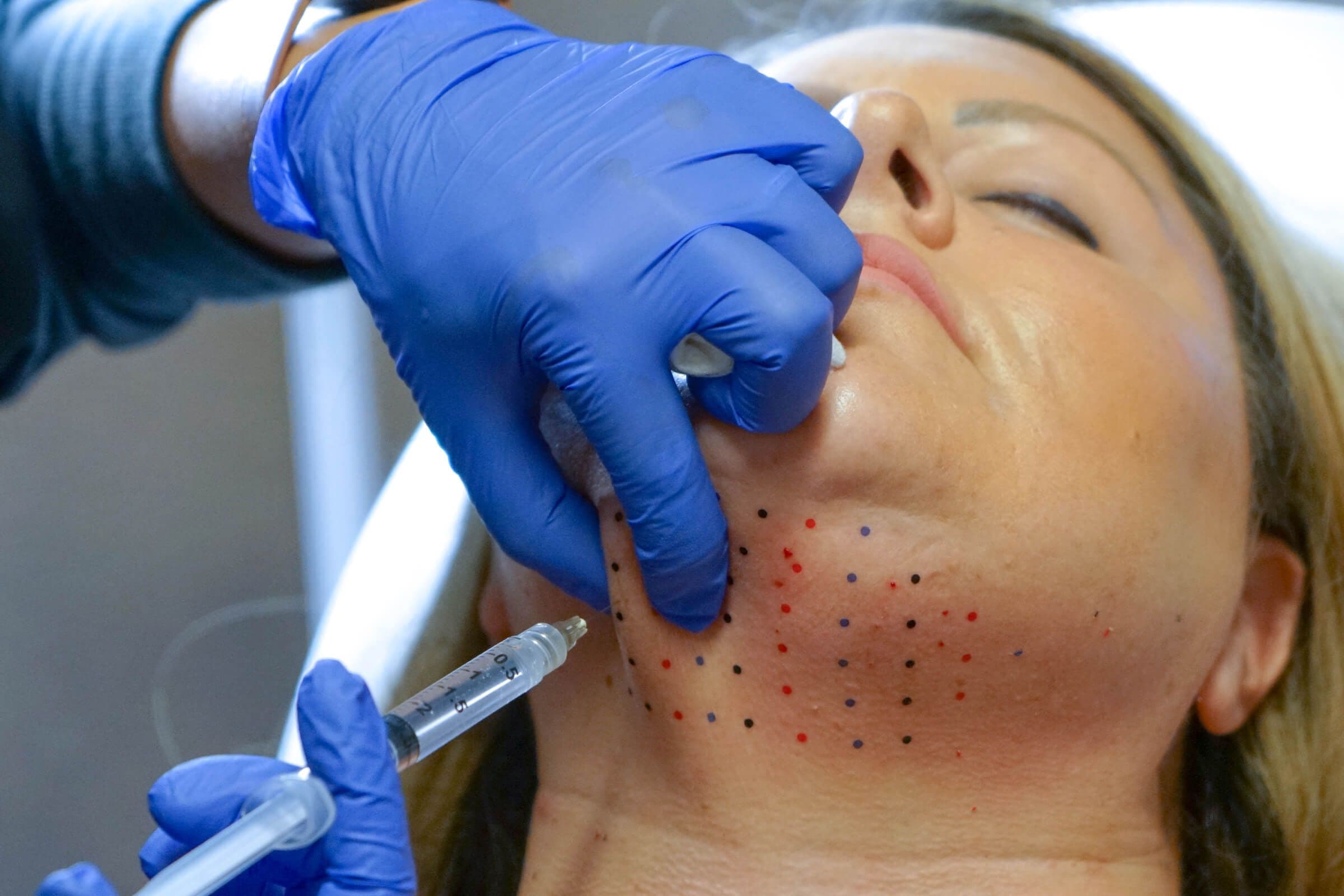 Kybella
