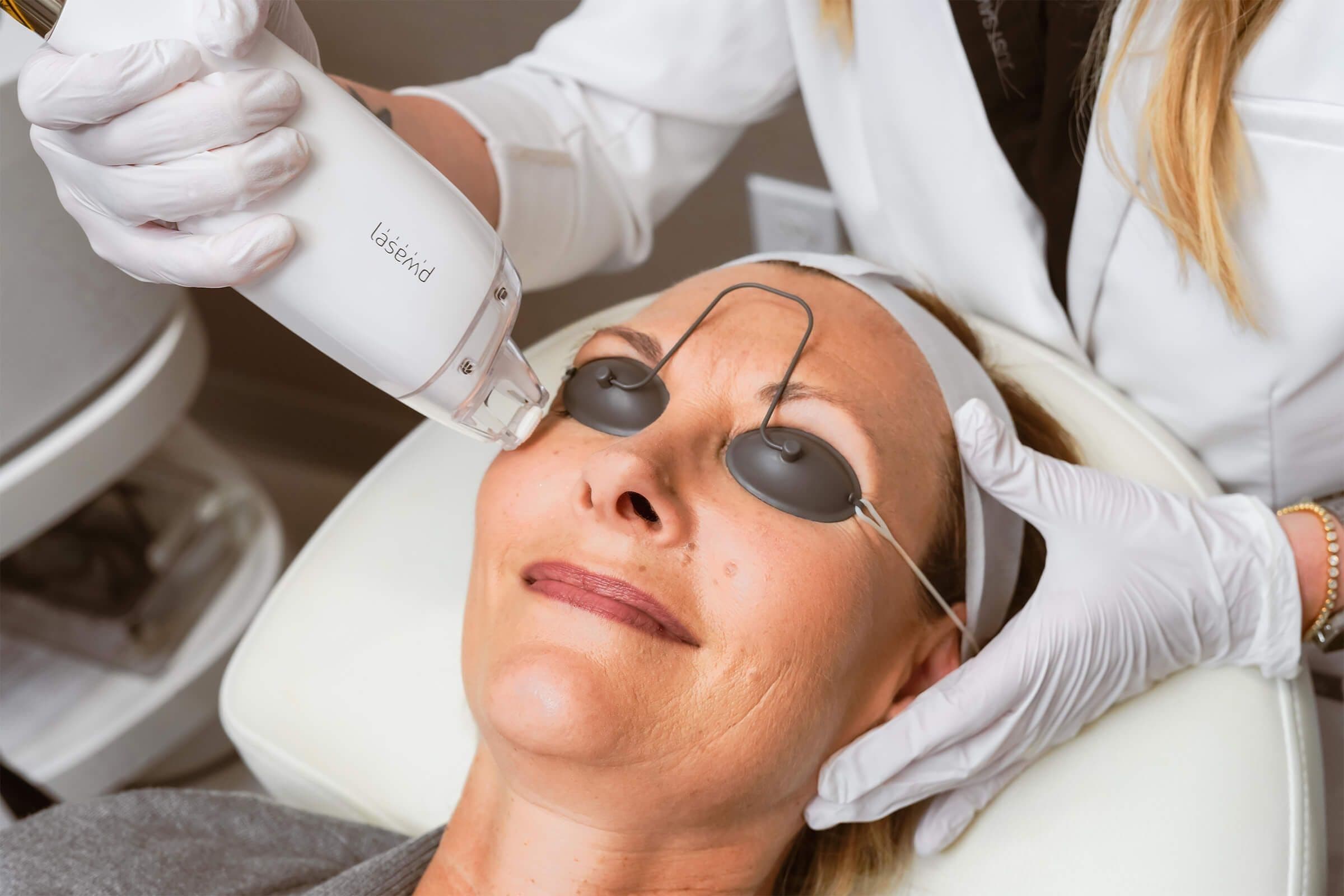 Laser Resurfacing