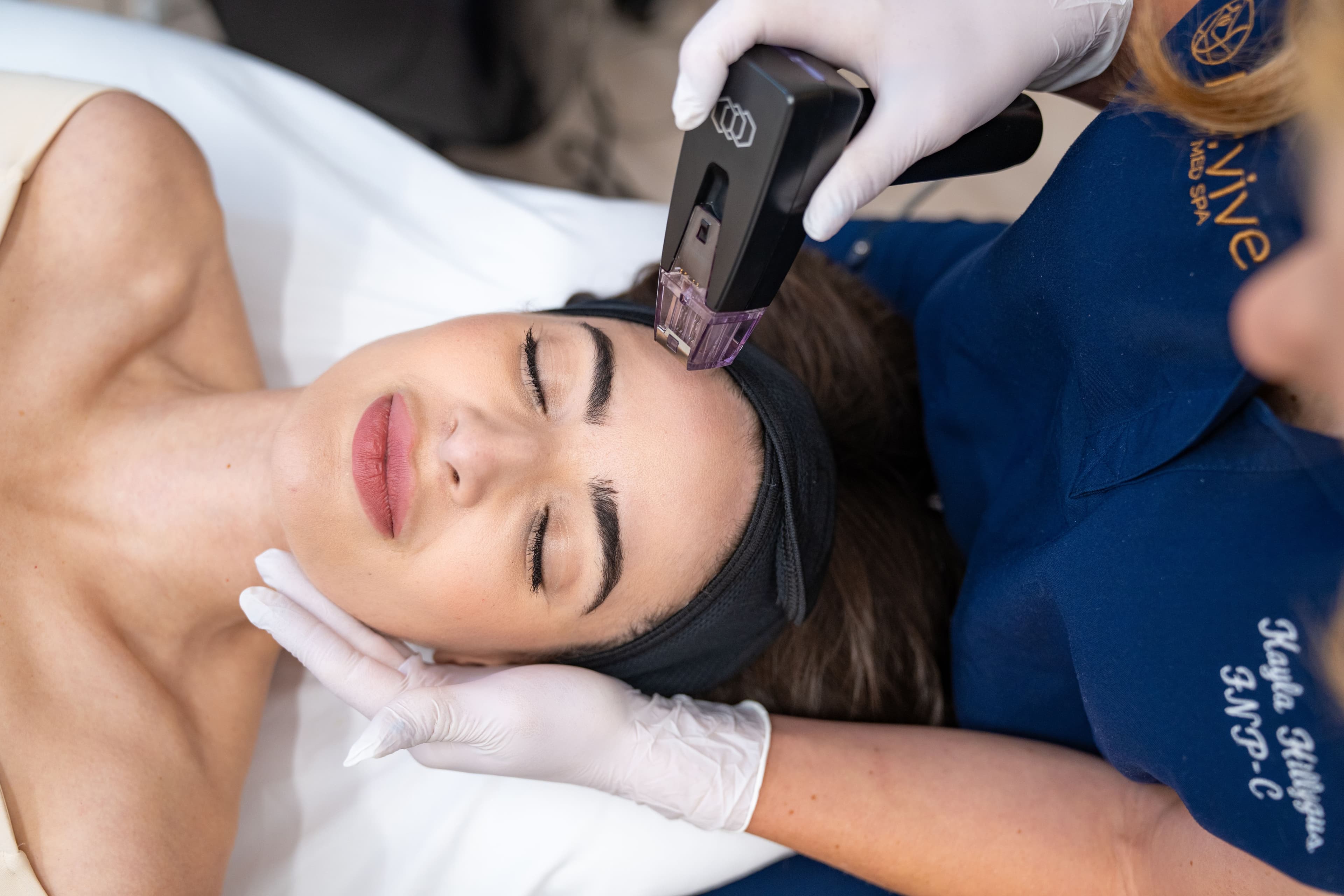Buy Three Morpheus8 Treatments, Get Three Microneedling Free