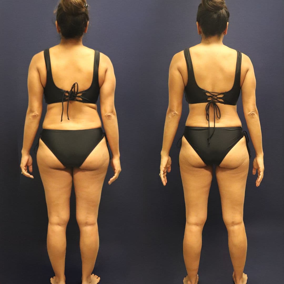 REV-002-Photos-BeforeandAfter.jpg