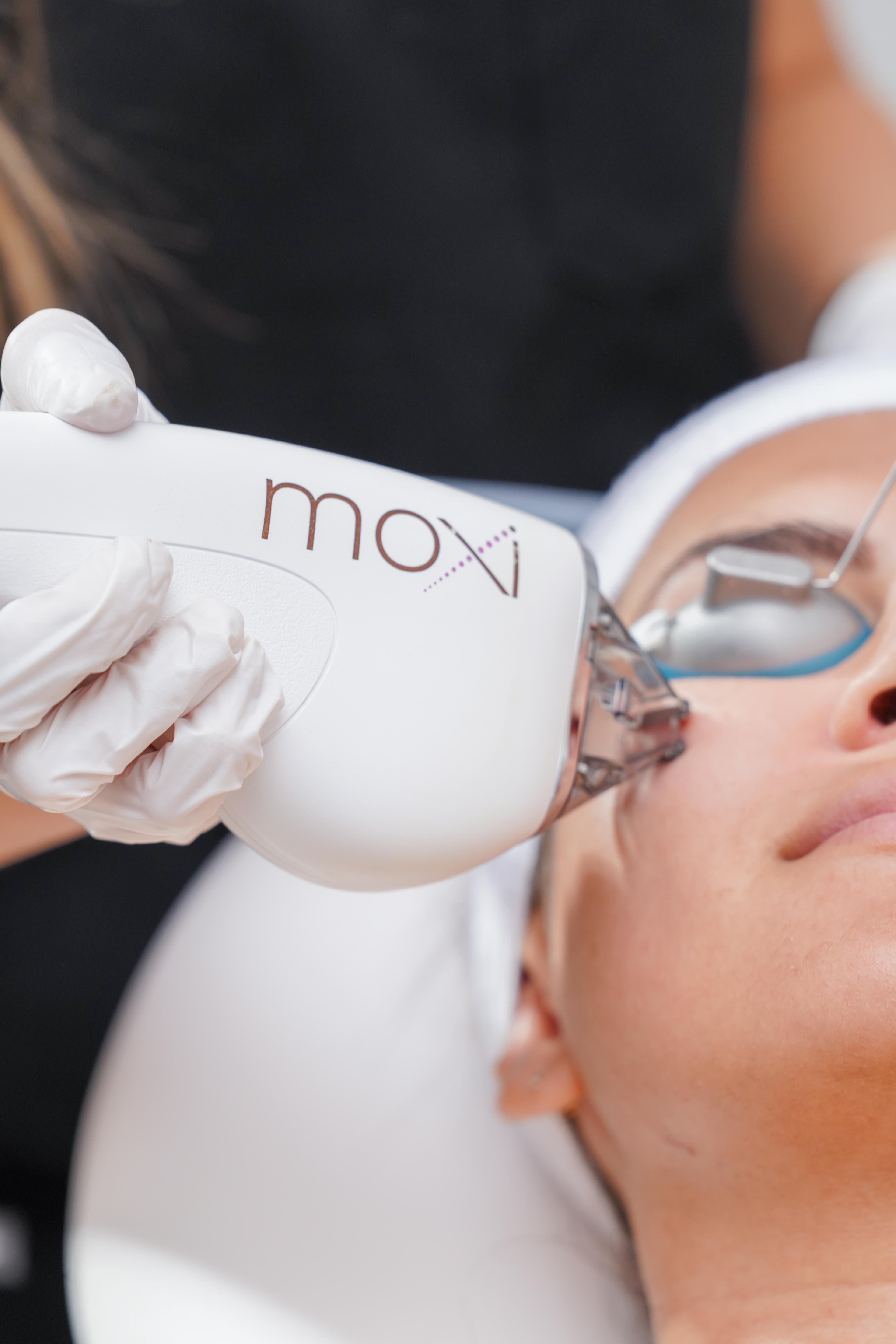 Moxi