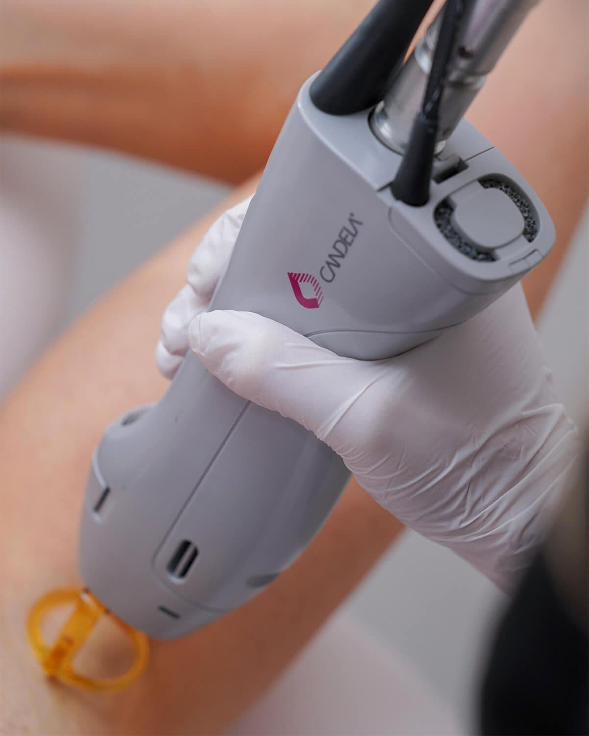RFM-Laser-Hair-Removal.jpg