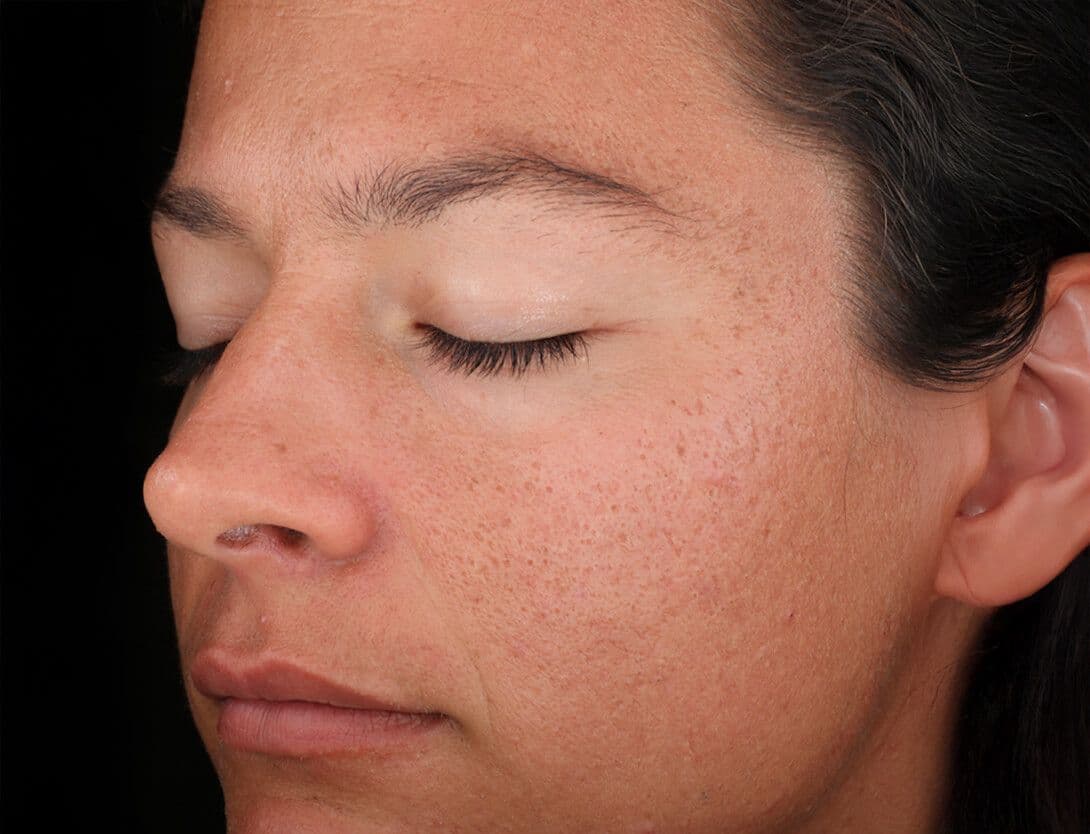 Rejuvenize Peel-1-Before.jpg