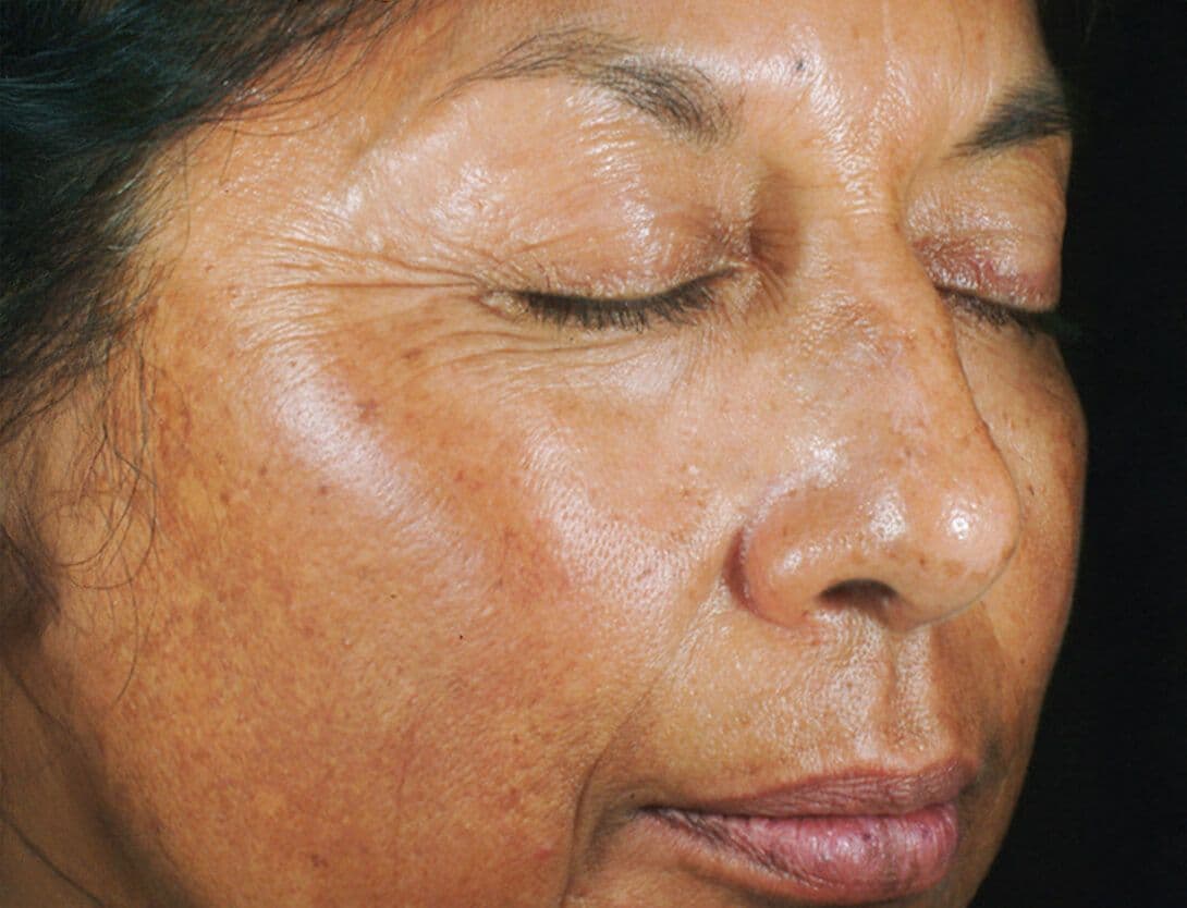 Rejuvenize Peel-2-Before.jpg