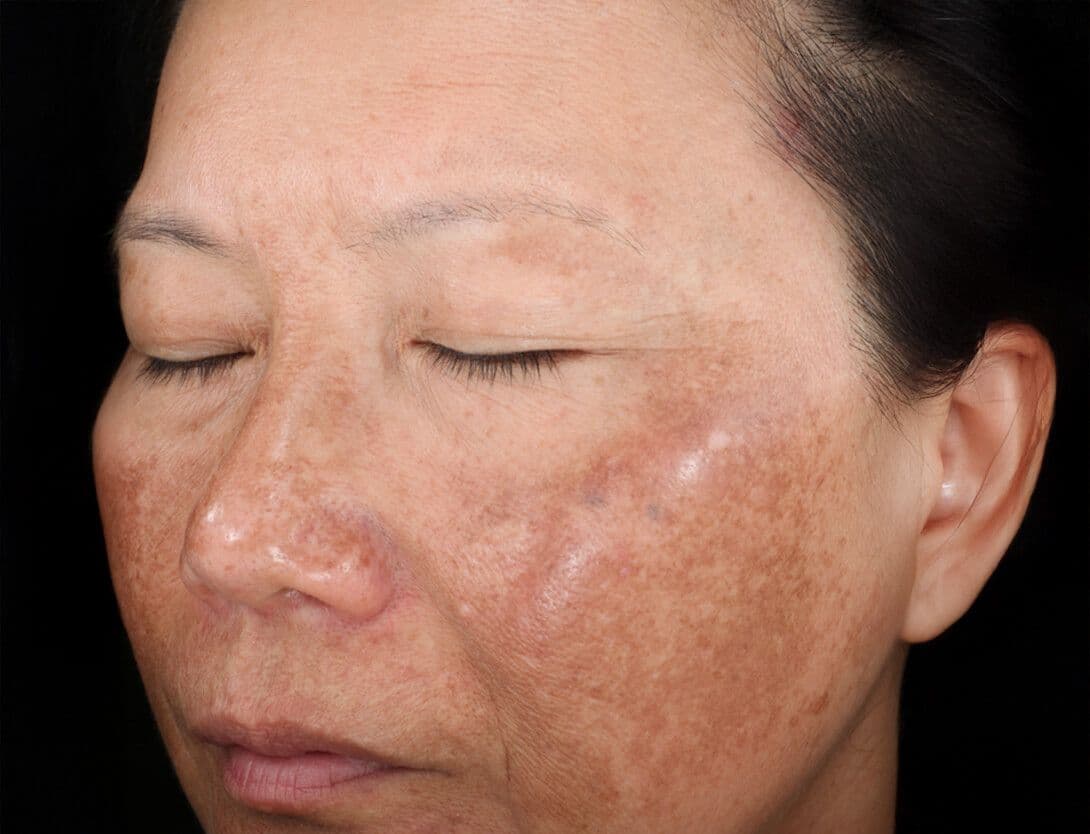 Rejuvenize Peel-3-Before.jpg