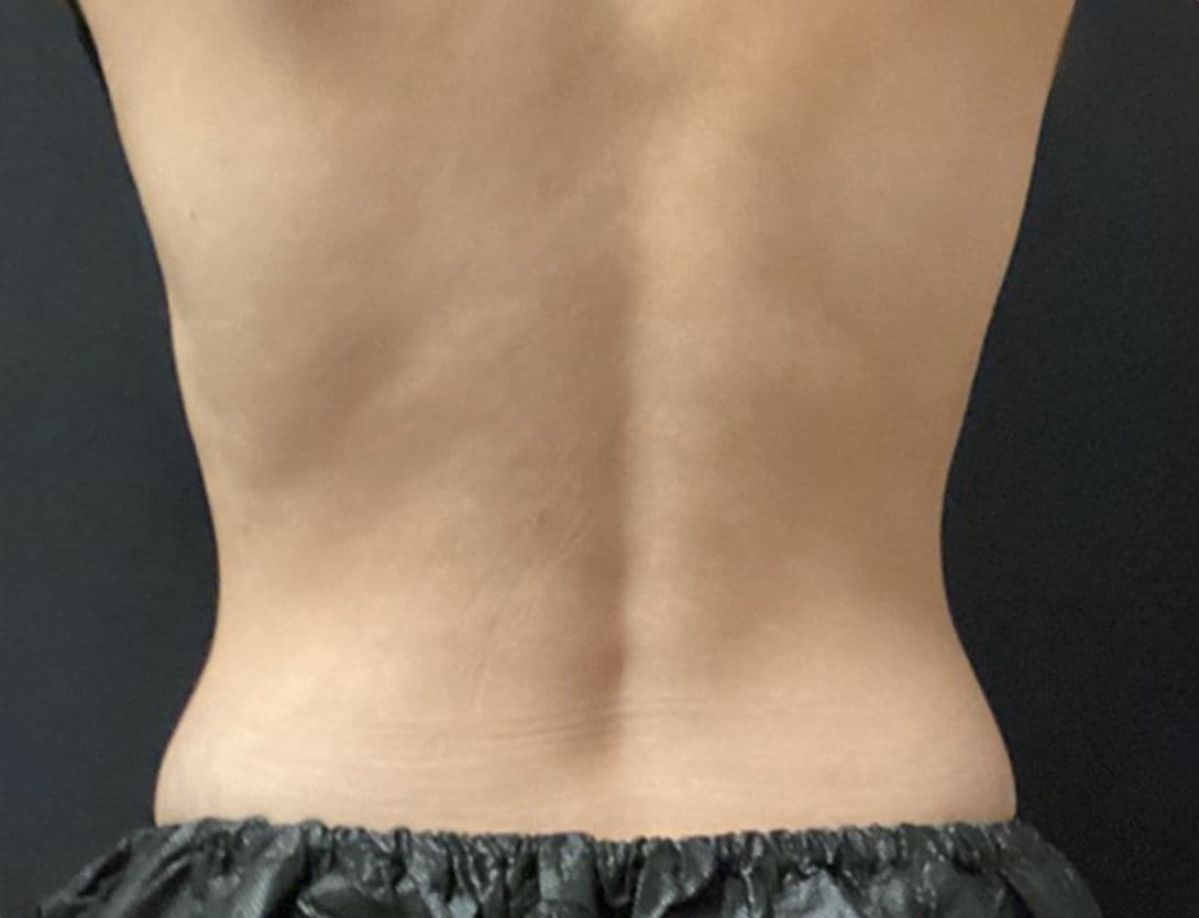 eva_lai_CS_back-After.jpg