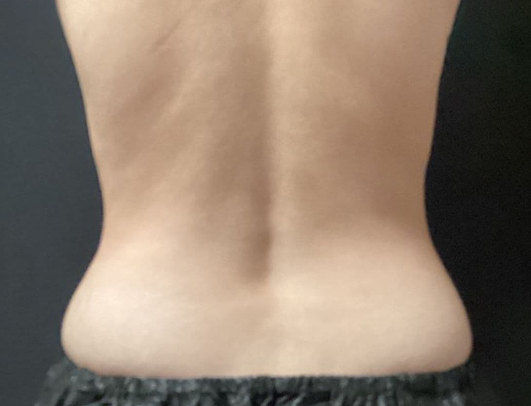 eva_lai_CS_back-Before.jpg