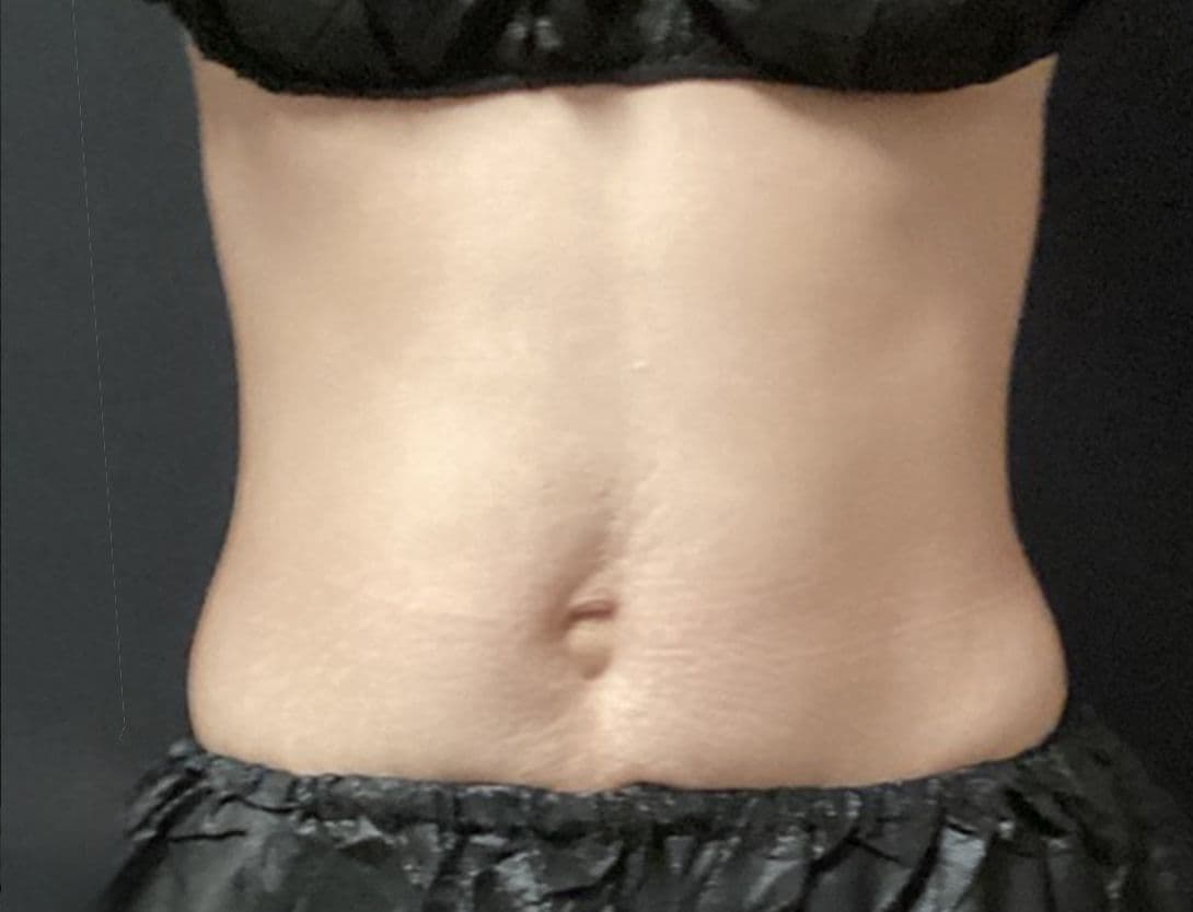 eva_lai_CS_front-After.jpg