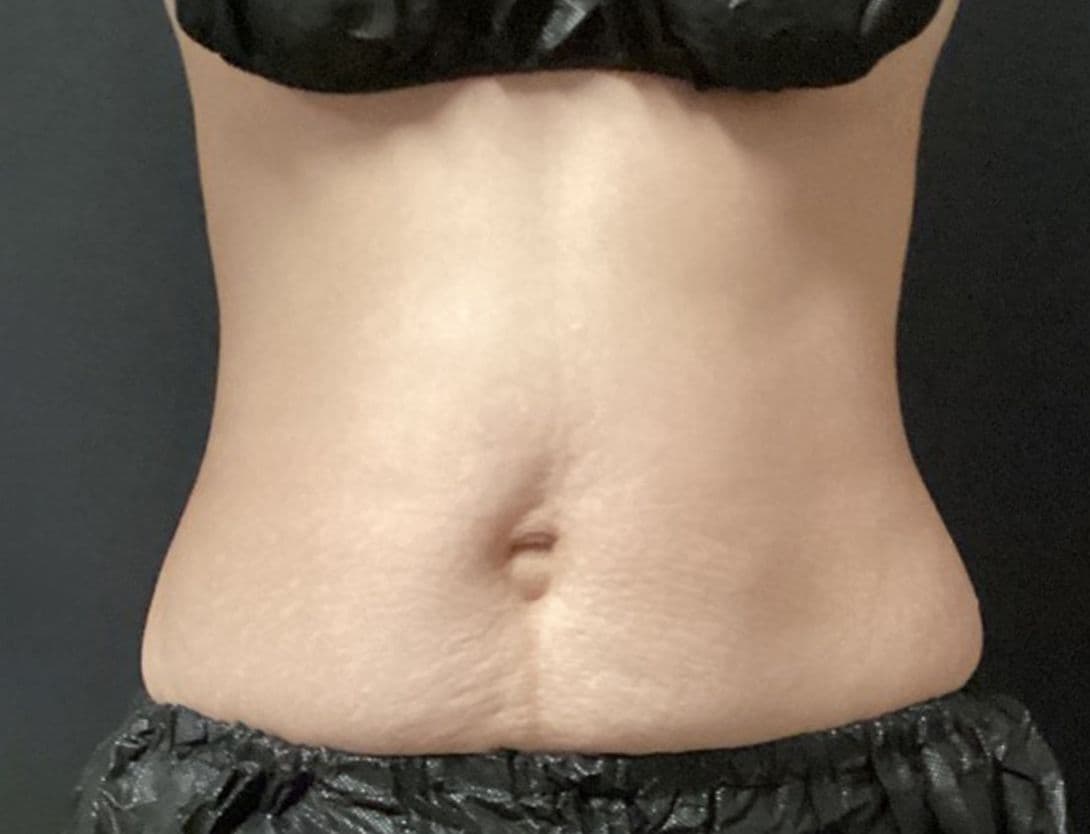 eva_lai_CS_front-Before.jpg