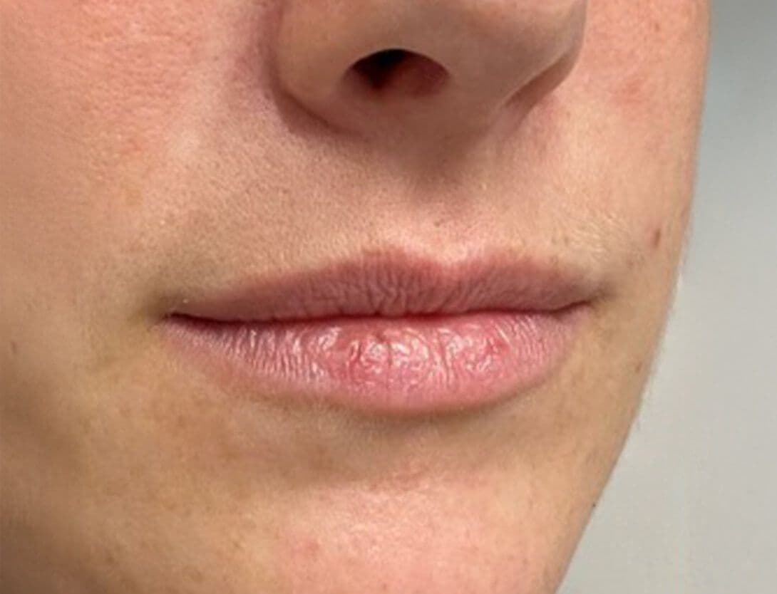 joy_pearson_lips-Before.jpg