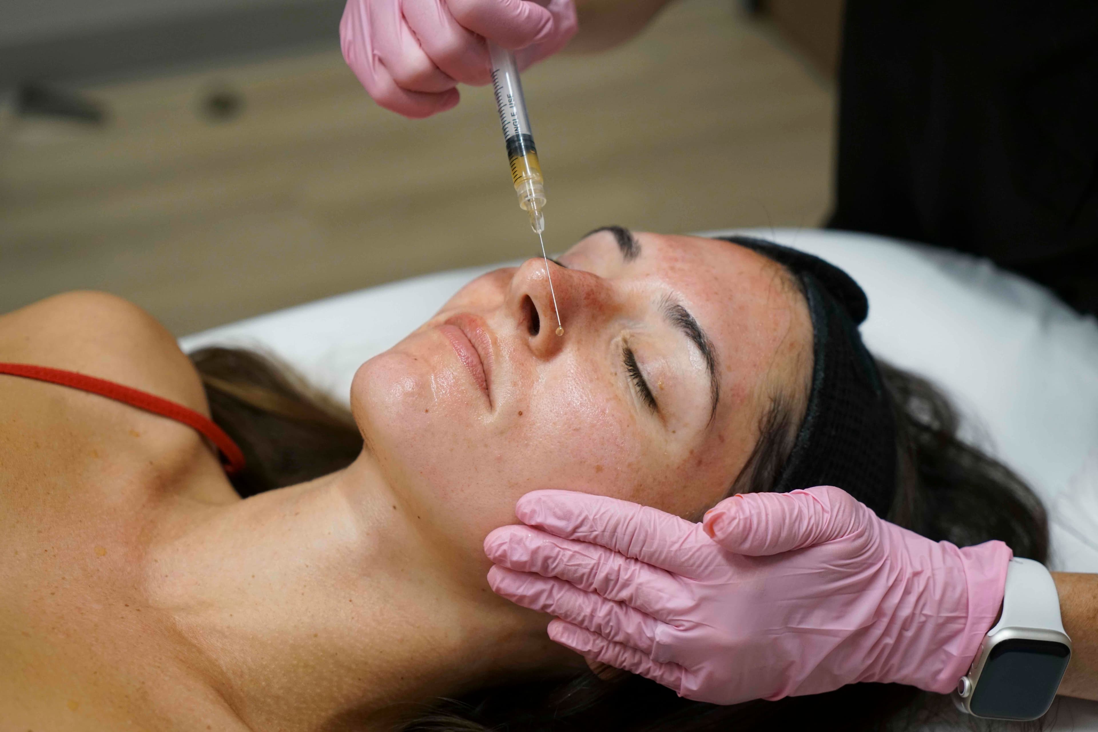 prp_microneedling_injections_15.jpg
