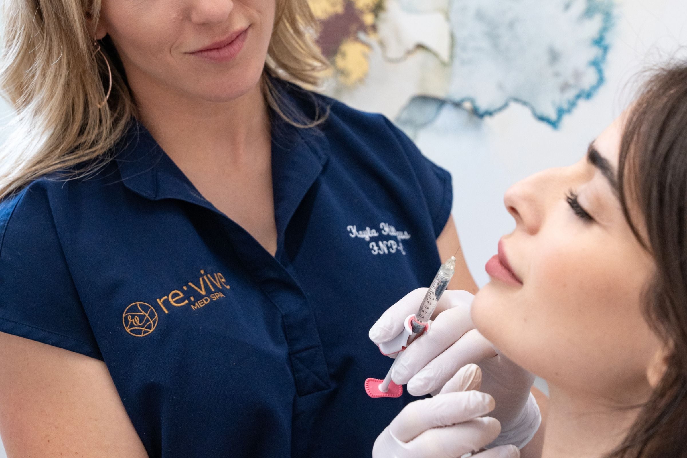 Woman receiving Juvederm hyaluronic acid filler injection