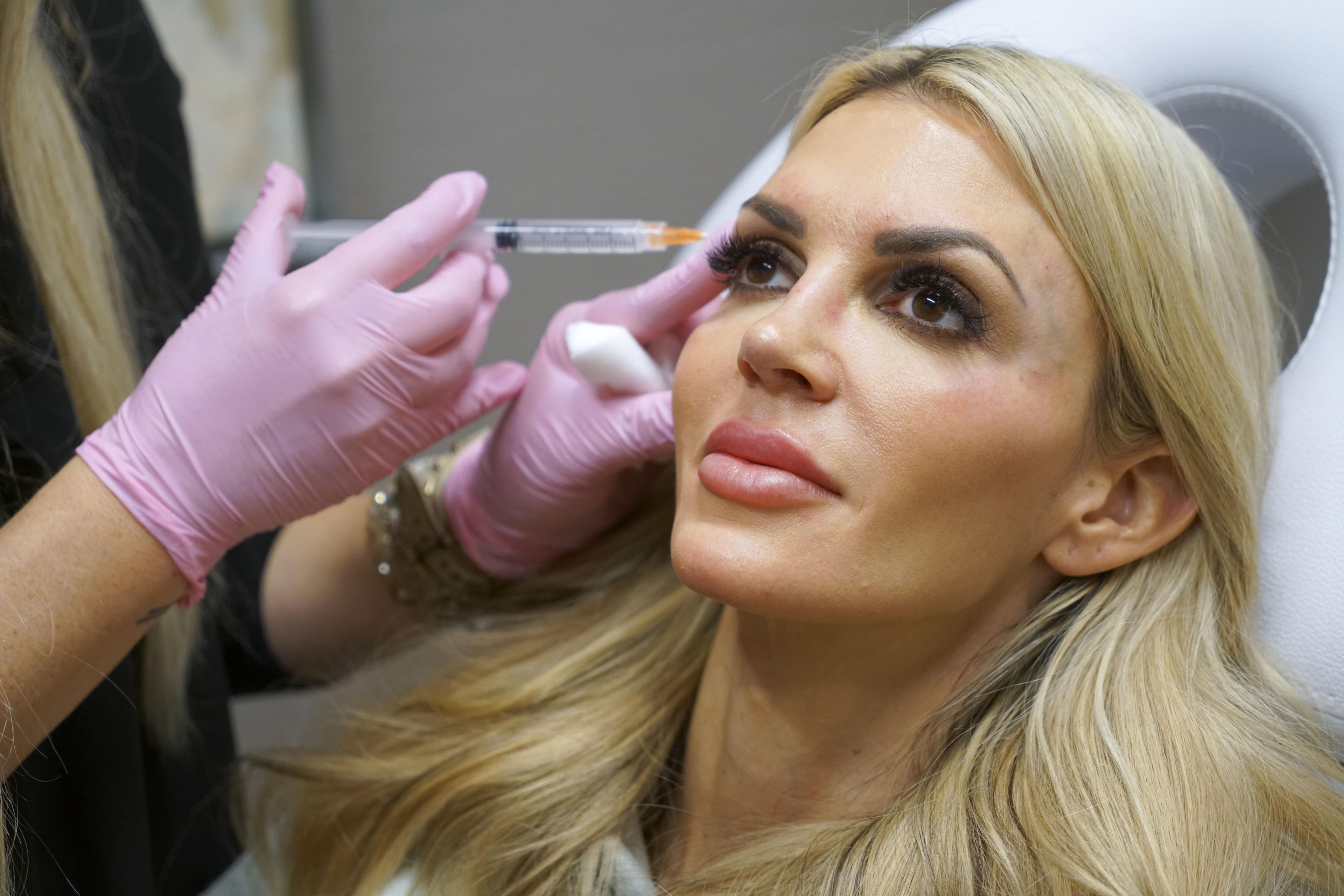 ashley_3rd_sculptra_12.JPG