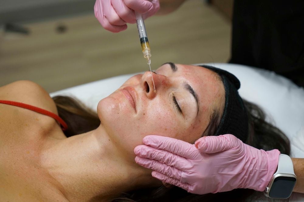 prp_microneedling_injections_15 (2).jpg