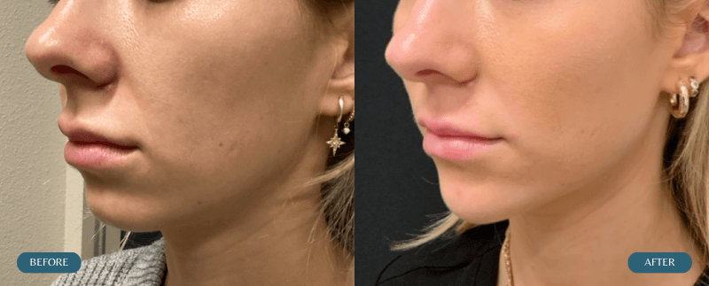 Jenni Before & After